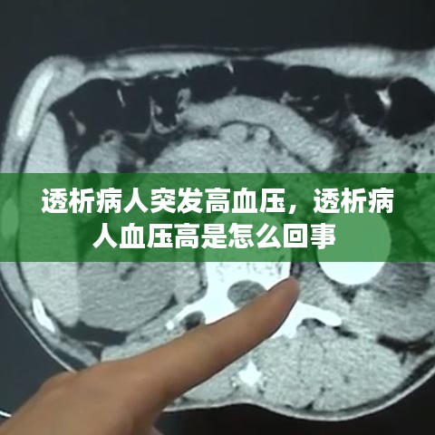 透析病人突发高血压,透析病人血压高是怎么回事